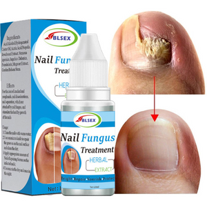 FUNGIKILL - Tratamiento de hongos en las uñas  ( PIES SANOS)