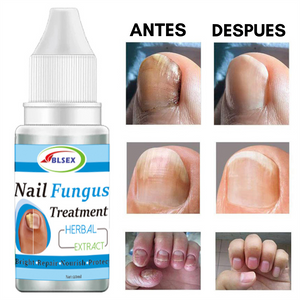 FUNGIKILL - Tratamiento de hongos en las uñas  ( PIES SANOS)